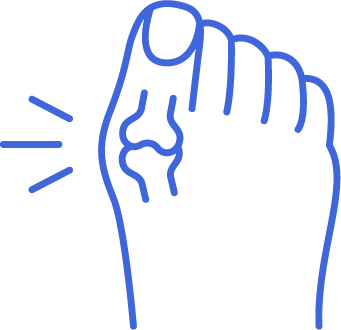 Icon for Bunion