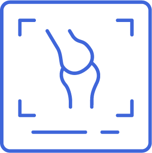 Icon for Chondromalacia Patellae