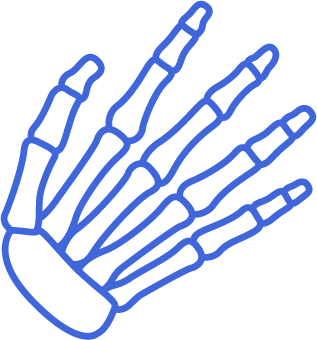 Icon for Dupuytrens Contracture