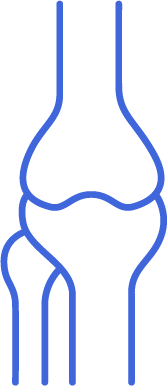 Icon for Lateral Meniscal Tear
