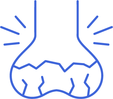 Icon for Rheumatoid Arthritis