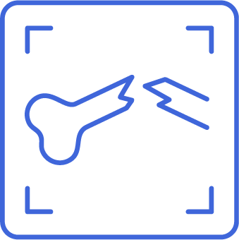 Icon for Sprained Ankle